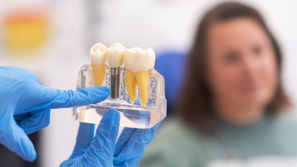 A New Smile Awaits: The Process of Dental Implants in Reading